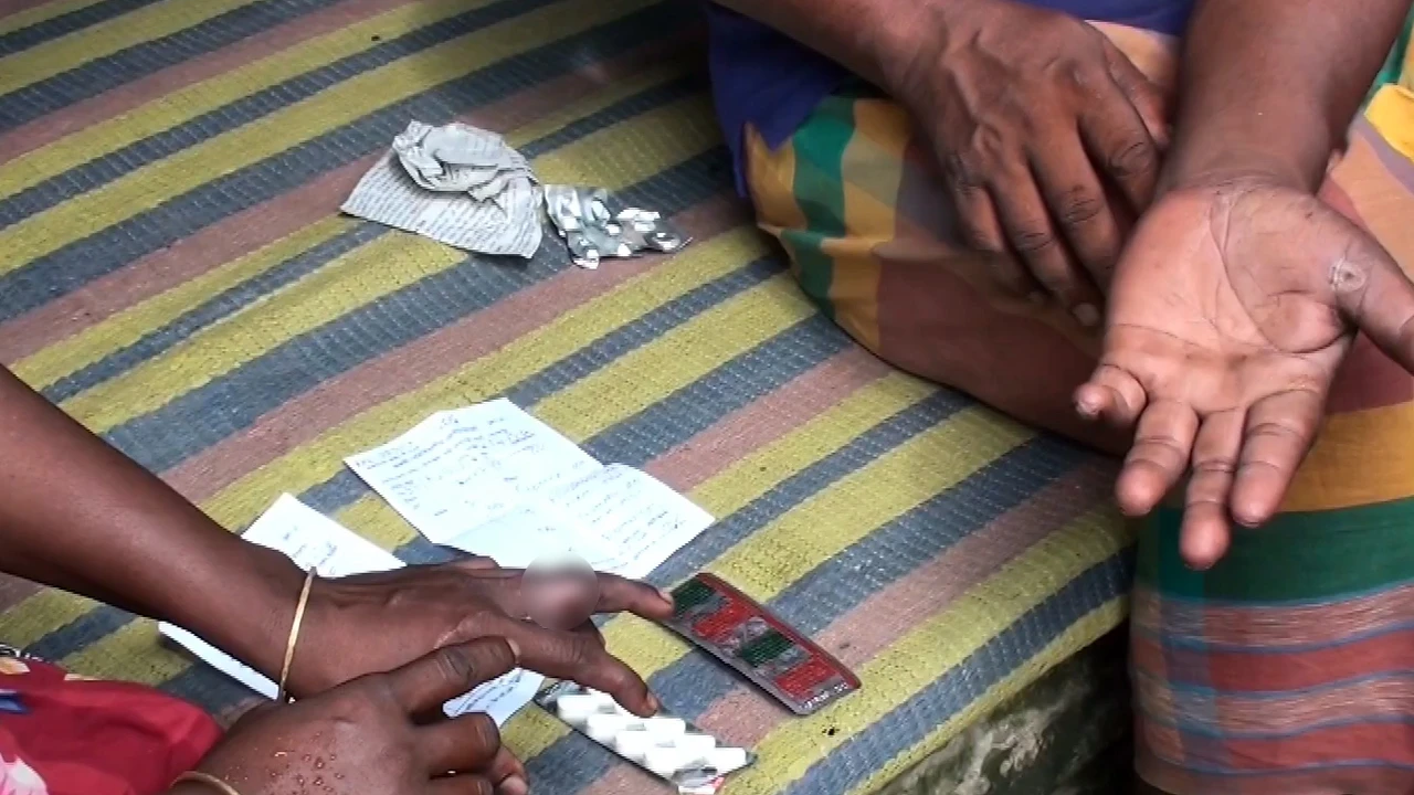 গাংনীতে বাড়ছে অ্যানথ্রাক্সের সংক্রমণ, চলতি বছরেই আক্রান্ত ৪১২
