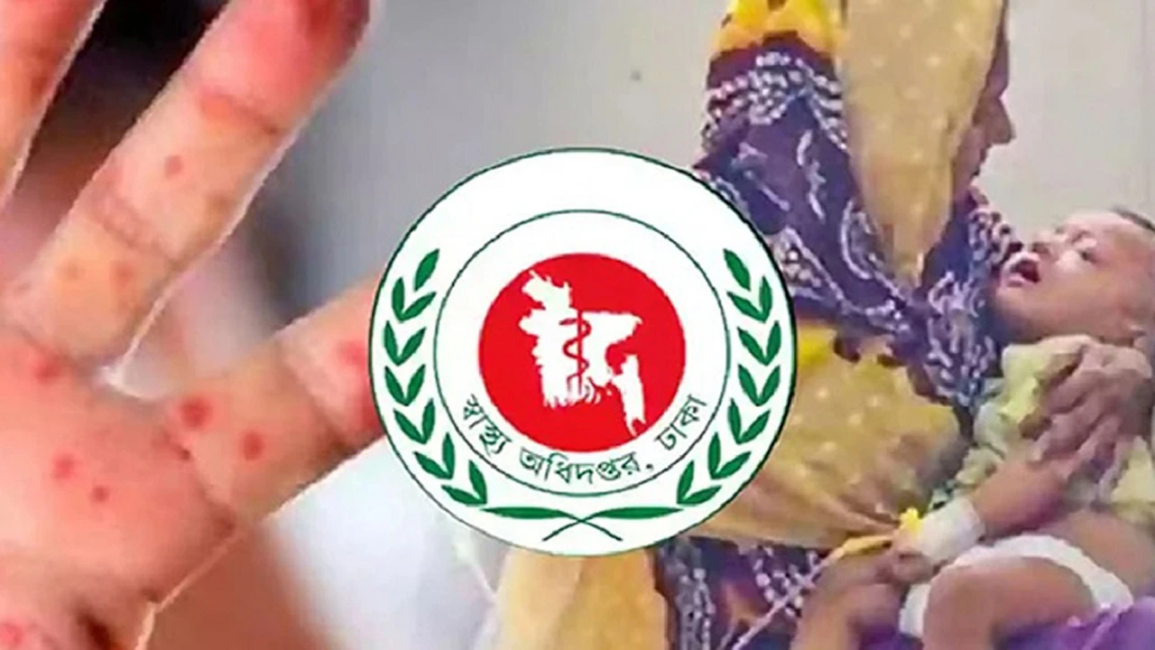 হামের উপসর্গে আরও দুই শিশুর মৃত্যু